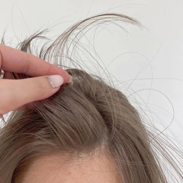 白头发可以不染黑发吗