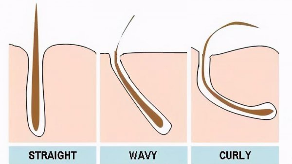 中国自来卷是什么血统