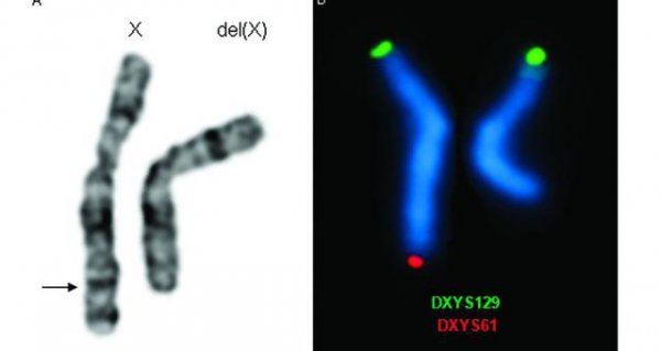 人的寿命由什么决定