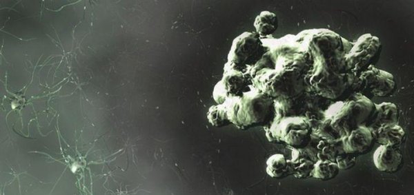 世界上最可怕的病毒第一名