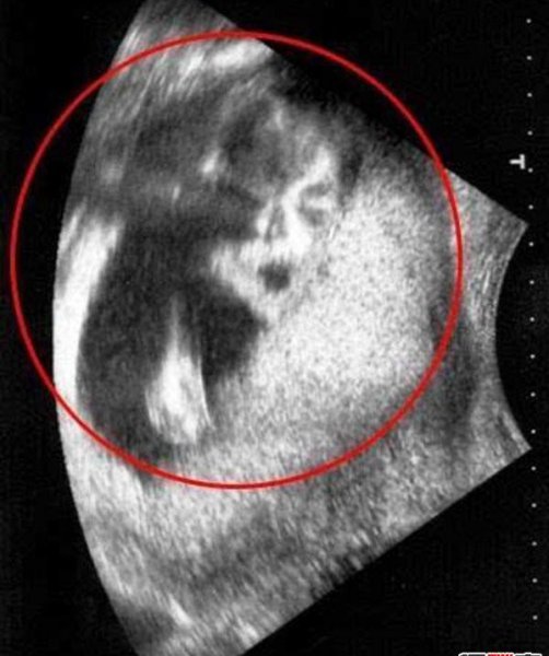 震惊全球十大灵异事件