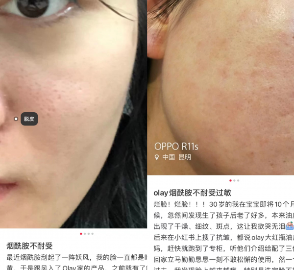 美白精华真的能美白吗