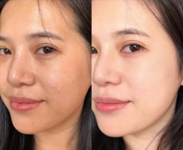 美白精华真的能美白吗