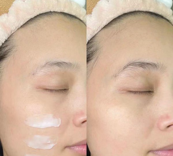 美白精华真的能美白吗