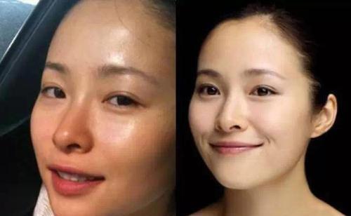 美白精华真的能美白吗