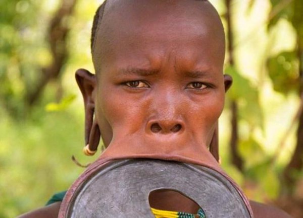 所谓的非洲割礼是什么意思