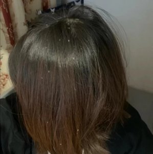 口碑最好的去屑洗发水 推荐去屑止痒好用的良心洗发水