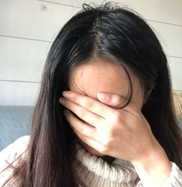 口碑最好的去屑洗发水