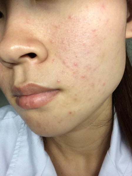 为什么每天化妆反而皮肤变好