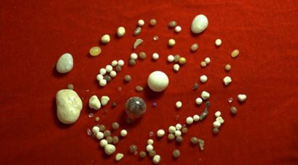 佛骨舍利是什么东西