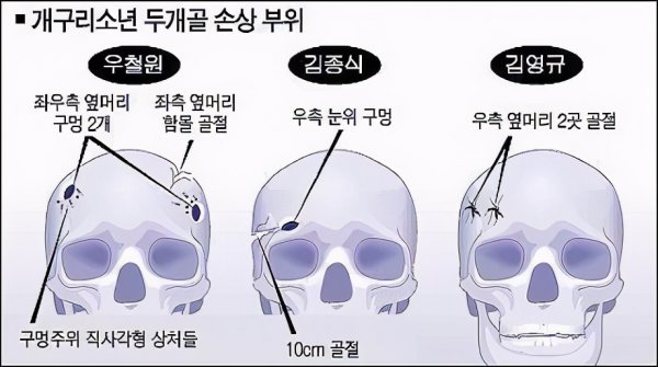 青蛙少年失踪事件真相