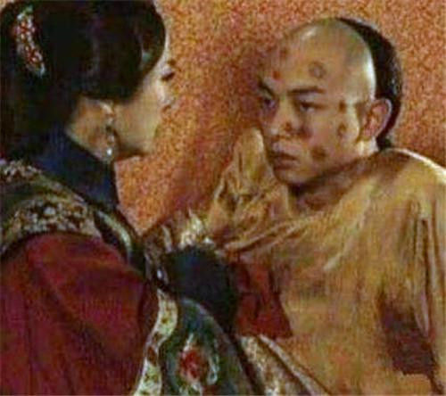 天花什么时候消灭的