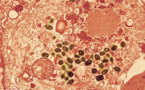 天花什么时候消灭的