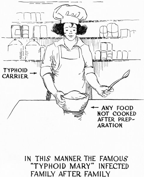 伤寒玛丽的故事