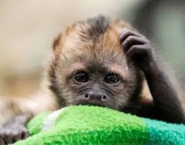 头皮屑多如何去除小妙招 教你怎样快速去头皮屑的方法