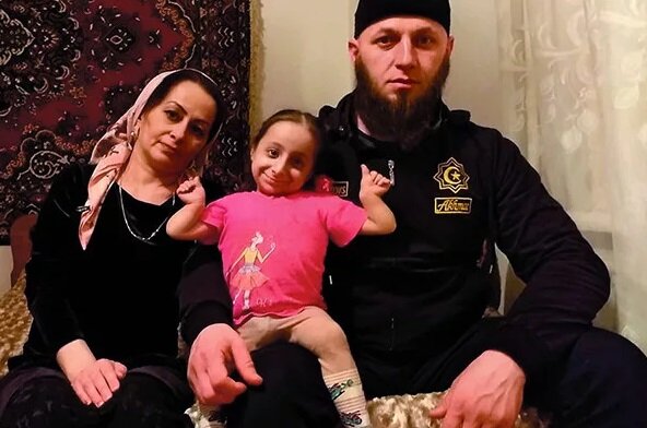 世界最矮小女性乔蒂·阿姆奇