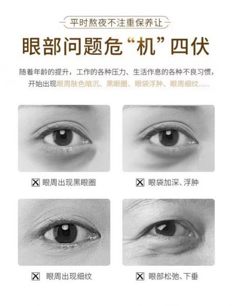 郑明明的眼霜真的能去眼袋吗