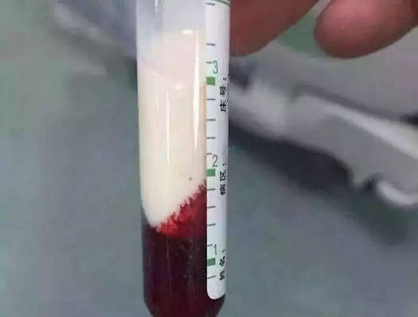 细鳞太攀蛇简介