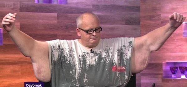 世界上最胖的男人保罗梅森