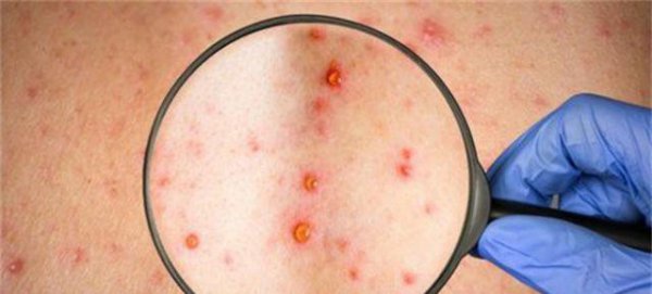 身上长红点是什么原因