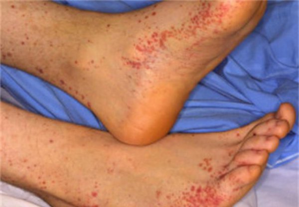 身上长红点是什么原因