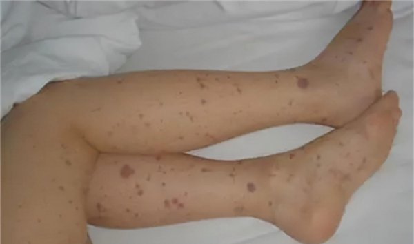 身上长红点是什么原因