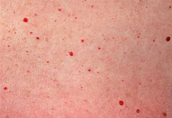 身上长红点是什么原因