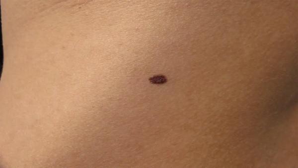 身上长红点是什么原因