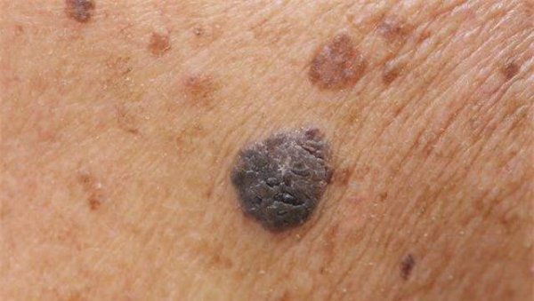 身上长红点是什么原因