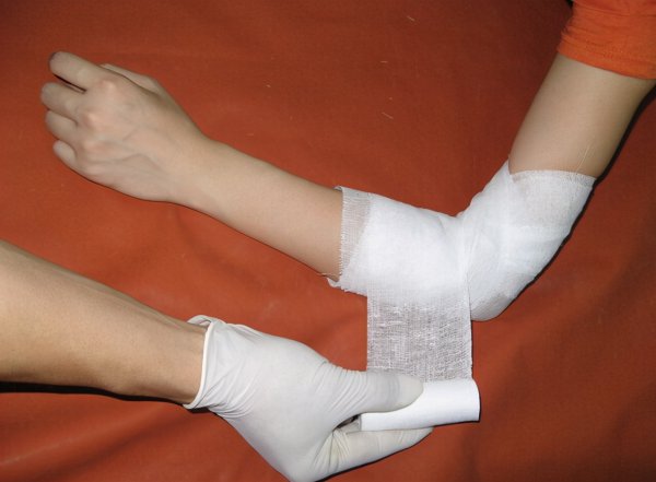 科莫多巨蜥有毒吗