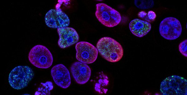 75%酒精消毒原理是什么