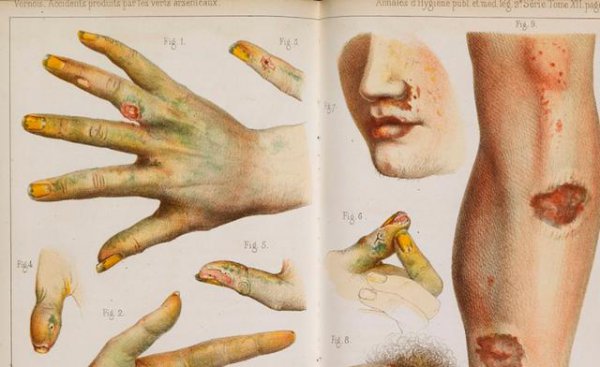 二战时期慰安妇意外怀孕怎么办