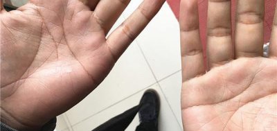 男的断掌代表什么意思 男性断掌说明男人命好不好