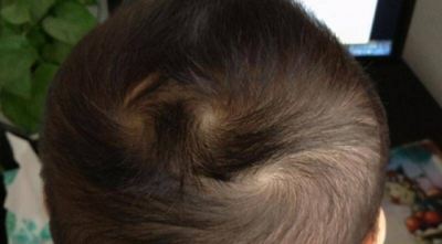 头上有两个旋的男孩意味着什么 头中间两个旋男孩说法