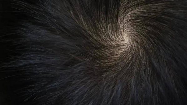 头上有两个旋的男孩意味着什么