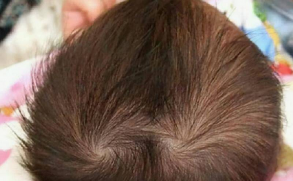 头上有两个旋的男孩意味着什么