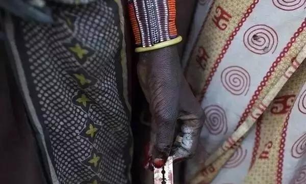 女性割礼后还能生育吗