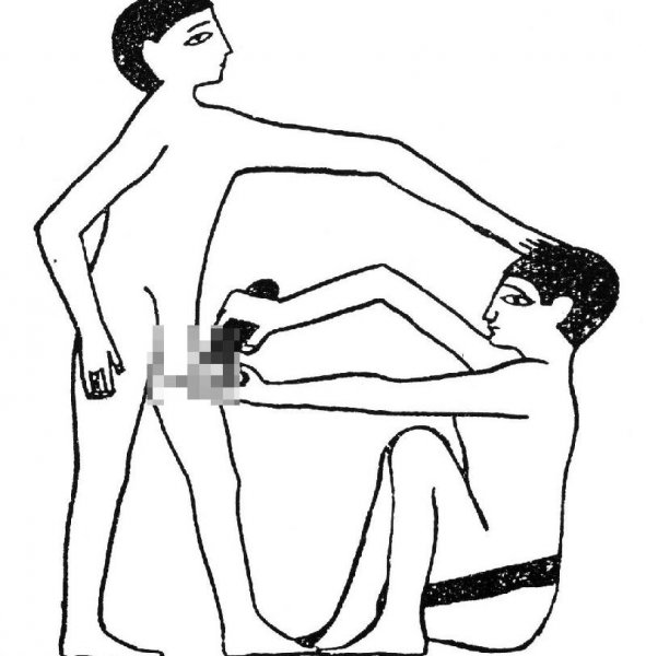 女性割礼指的是什么意思