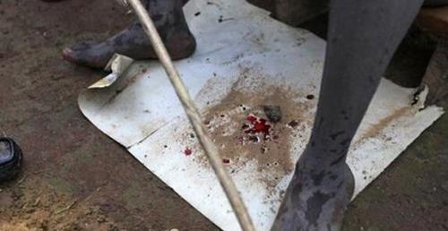 女性割礼指的是什么意思