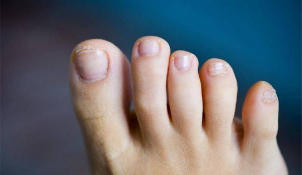 小脚趾甲两瓣是哪族人