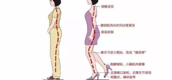 鞋磨脚后跟的小妙招