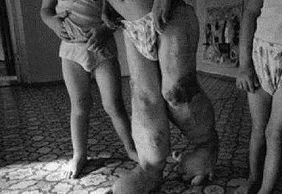 切尔诺贝利现在怎么样