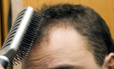 哪种梳子梳头好 什么样的梳子对头发最健康