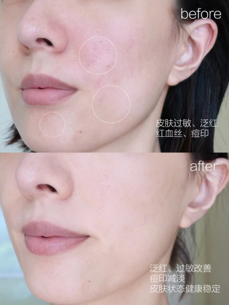 去皱护肤品哪种好