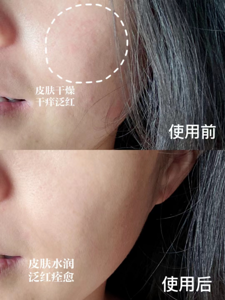 去皱护肤品哪种好