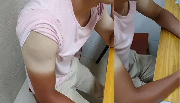 冰袖什么牌子好