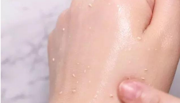 化妆品搓泥是怎么回事