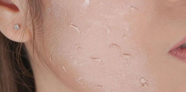 化妆品搓泥是怎么回事