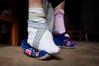 简述裹脚的历史起源 封建时期的女性是怎么裹脚的