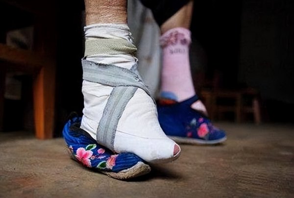 简述裹脚的历史起源